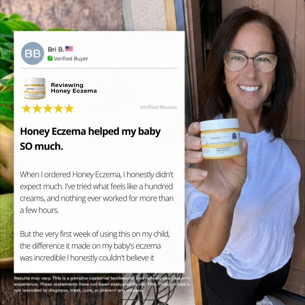 HoneyEczema - Protect Your Baby From Painful Eczema