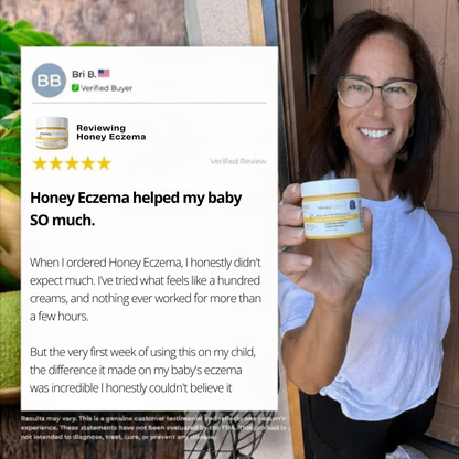 HoneyEczema - Protect Your Baby From Painful Eczema