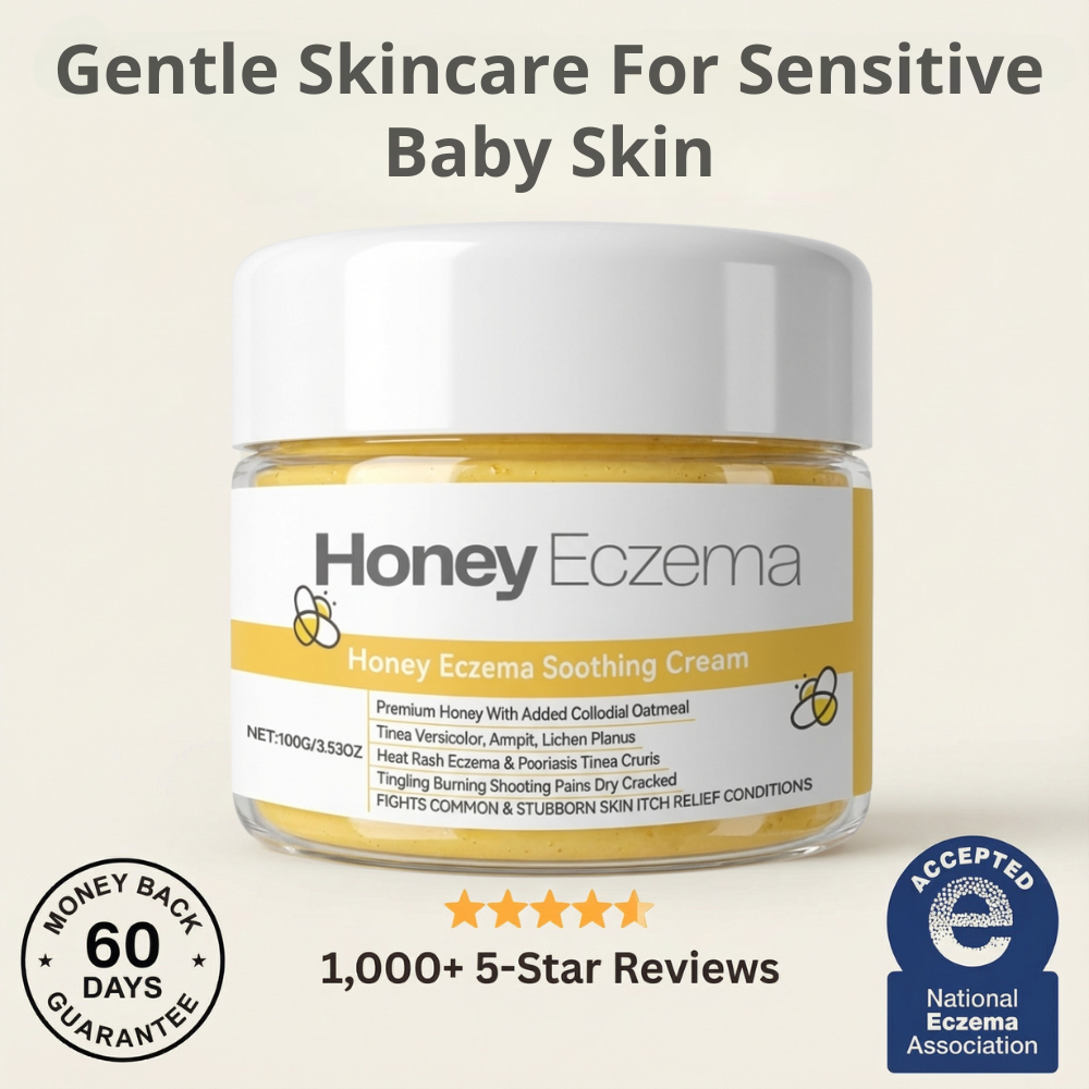 Honey Eczema